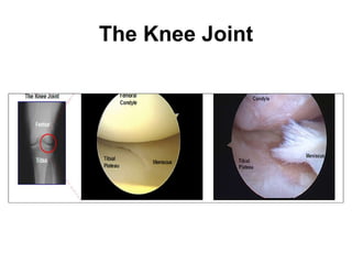 The Knee Joint 