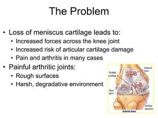 Loss of meniscus cartilage leads to: Increased forces across the knee joint Increased risk of articular cartilage damage Pain and arthritis in many cases Painful arthritic joints: Rough surfaces Harsh, degradative environment The Problem 