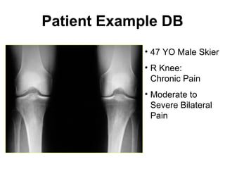Patient Example DB 47 YO Male Skier R Knee:  Chronic Pain Moderate to Severe Bilateral Pain 