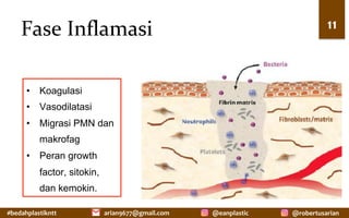 #bedahplastikntt	 @robertusarian	
arian9677@gmail.com	 @eanplastic	
Fase	Inflamasi	 11	
•  Koagulasi
•  Vasodilatasi
•  Migrasi PMN dan
makrofag
•  Peran growth
factor, sitokin,
dan kemokin.
 