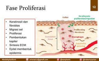 #bedahplastikntt	 @robertusarian	
arian9677@gmail.com	 @eanplastic	
Fase	Proliferasi	 12	
•  Keratinosit dan
fibroblas
•  Migrasi sel
•  Proliferasi
•  Pembentukan
kapiler
•  Sintesis ECM
•  Epitel membentuk
epidermis
 