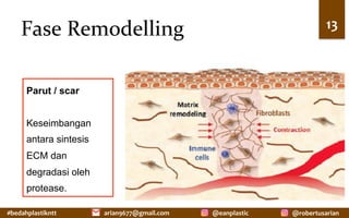 #bedahplastikntt	 @robertusarian	
arian9677@gmail.com	 @eanplastic	
Fase	Remodelling	 13	
Parut / scar
Keseimbangan
antara sintesis
ECM dan
degradasi oleh
protease.
 