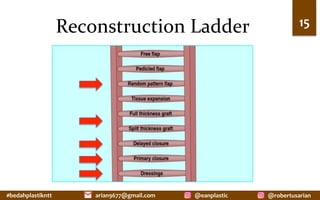 #bedahplastikntt	 @robertusarian	
arian9677@gmail.com	 @eanplastic	
Reconstruction	Ladder	 15	
 
