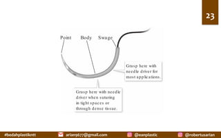 #bedahplastikntt	 @robertusarian	
arian9677@gmail.com	 @eanplastic	
23	
reverse cutting; ins
needles as convent
cutting needles a
rule. For example, a semicircular P-2 needle
may be used or narrow closures, such as
those sometimes encountered on the nose,
TABLE3-1 COMPAR
USEDREVERSECUTT
ETHICON ANDCOVID
Ethicon
P-1
P-3
PS-1
PS-2
CP-2
FS-1
FS-2
P-2
Comparisondoes not imply
nishqualitywithinandbe
3/8circle indiameterexce
Point Body Swage
Grasp here with needle
driver when suturing
in tight spaces or
through dense tissue.
Grasp here with
needle driver for
most applications.
Figure 3-1. The suture needle.
 