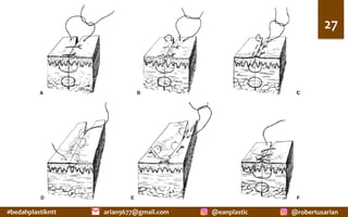 #bedahplastikntt	 @robertusarian	
arian9677@gmail.com	 @eanplastic	
27	
A B c
D E F
 