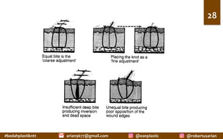 #bedahplastikntt	 @robertusarian	
arian9677@gmail.com	 @eanplastic	
28	
 