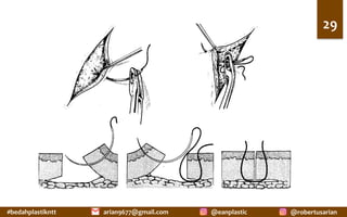 #bedahplastikntt	 @robertusarian	
arian9677@gmail.com	 @eanplastic	
29	
 