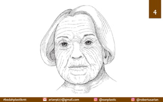 #bedahplastikntt	 @robertusarian	
arian9677@gmail.com	 @eanplastic	
4	
 