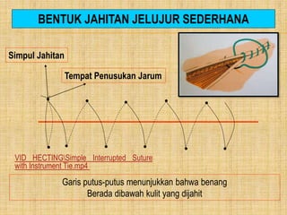 Menjahit Luka Dengan Bermacam Teknik | PPTX