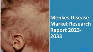 Menkes Disease
Market Research
Report 2023-
2033
 