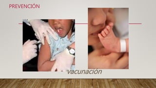 PREVENCIÓN
vacunación
 