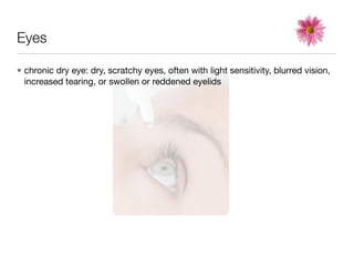 Eyes

• chronic dry eye: dry, scratchy eyes, often with light sensitivity, blurred vision,
  increased tearing, or swollen or reddened eyelids
 