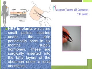 HRT implants which are
small pellets inserted
under the skin
periodically once in six
months supply
hormones. These are
surgically inserted into
the fatty layers of the
abdomen under a local
anesthetic.
 
