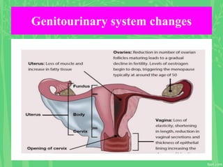 Genitourinary system changes
 
