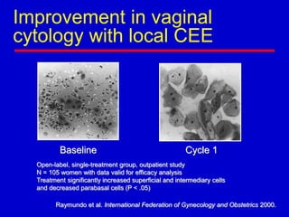 Improvement in vaginal
cytology with local CEE
Baseline Cycle 1
Raymundo et al. International Federation of Gynecology and Obstetrics 2000.
Open-label, single-treatment group, outpatient study
N = 105 women with data valid for efficacy analysis
Treatment significantly increased superficial and intermediary cells
and decreased parabasal cells (P < .05)
 