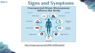 Signs and Symptoms
Slide:5
https://images.app.goo.gl/Vy8DEL3E8RinpzBm6
 