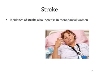 Stroke
• Incidence of stroke also increase in menopausal women
28
 