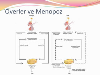 Overler ve Menopoz