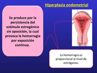 Hiperplasia endometrial
La hemorragia es
proporcional al nivel de
estrógenos.
Se produce por la
persistencia del
estímulo estrogénico
sin oposición, la cual
provoca la hemorragia
por exposición
continua.
 