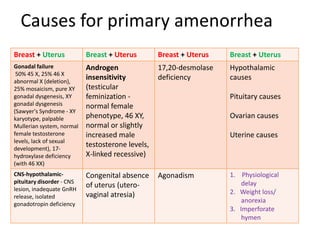 Causes for primary amenorrhea
Breast + Uterus            Breast + Uterus        Breast + Uterus   Breast + Uterus
Gonadal failure            Androgen               17,20-desmolase   Hypothalamic
 50% 45 X, 25% 46 X
abnormal X (deletion),
                           insensitivity          deficiency        causes
25% mosaicism, pure XY     (testicular
gonadal dysgenesis, XY     feminization -                           Pituitary causes
gonadal dysgenesis         normal female
(Sawyer's Syndrome - XY
karyotype, palpable        phenotype, 46 XY,                        Ovarian causes
Mullerian system, normal   normal or slightly
female testosterone        increased male                           Uterine causes
levels, lack of sexual
development), 17-
                           testosterone levels,
hydroxylase deficiency     X-linked recessive)
(with 46 XX)
CNS-hypothalamic-          Congenital absence     Agonadism         1. Physiological
pituitary disorder - CNS                                                delay
lesion, inadequate GnRH
                           of uterus (utero-
                           vaginal atresia)                         2. Weight loss/
release, isolated
gonadotropin deficiency
                                                                        anorexia
                                                                    3. Imperforate
                                                                        hymen
 