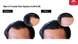 Men’s Frontal Hair System 0.04-0.06
 