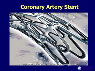 Coronary Artery Stent 