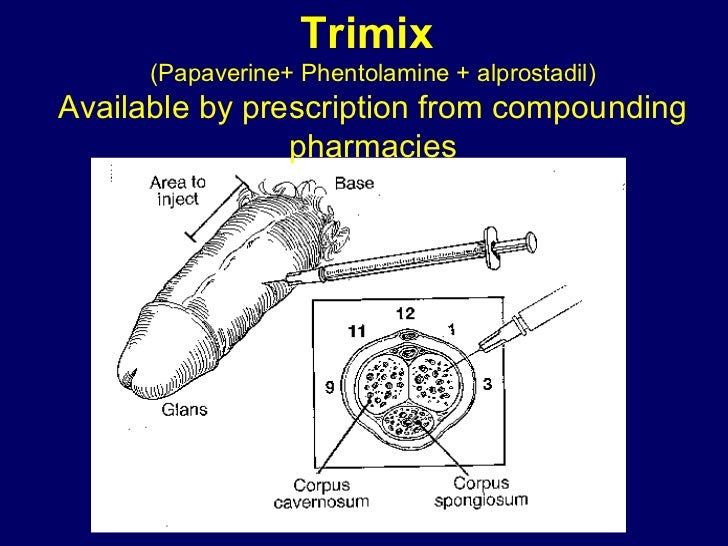 Men's Health Lecture by Nelson Vergel