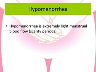 Hypomenorrhea
• Hypomenorrhea is extremely light menstrual
blood flow (scanty periods).
 