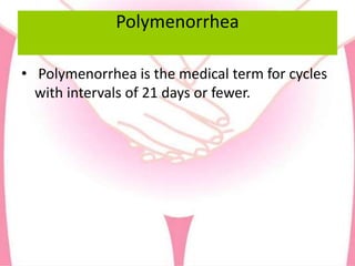 Polymenorrhea
• Polymenorrhea is the medical term for cycles
with intervals of 21 days or fewer.
 
