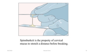 Msouda Asaira
Spinnbarkeit is the property of cervical
mucus to stretch a distance before breaking.
10/5/2024 19
 