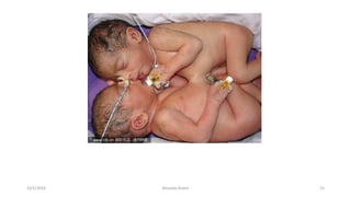 Msouda Asaira
10/5/2024 51
 