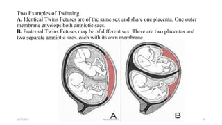 Two Examples of Twinning
A. Identical Twins Fetuses are of the same sex and share one placenta. One outer
membrane envelops both amniotic sacs.
B. Fraternal Twins Fetuses may be of different sex. There are two placentas and
two separate amniotic sacs, each with its own membrane
Msouda Asaira
10/5/2024 58
 