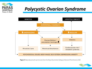 Polycystic Ovarian SyndromePolycystic Ovarian Syndrome
 