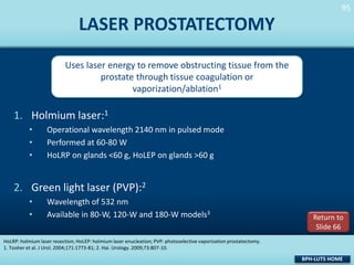 95
95

LASER PROSTATECTOMY
Uses laser energy to remove obstructing tissue from the
prostate through tissue coagulation or
vaporization/ablation1

1. Holmium laser:1
•
•
•

Operational wavelength 2140 nm in pulsed mode
Performed at 60-80 W
HoLRP on glands <60 g, HoLEP on glands >60 g

2. Green light laser (PVP):2
•
•

Wavelength of 532 nm
Available in 80-W, 120-W and 180-W models3

Return to
Slide 66

HoLRP: holmium laser resection; HoLEP: holmium laser enucleation; PVP: photoselective vaporization prostatectomy.
1. Tooher et al. J Urol. 2004;171:1773-81; 2. Hai. Urology. 2009;73:807-10.

BPH-LUTS HOME

 