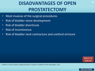 DISADVANTAGES OF OPEN
PROSTATECTOMY
•
•
•
•
•

99
99

Most invasive of the surgical procedures
Risk of bladder stone development
Risk of bladder diverticula
Risk of incontinence
Risk of bladder neck contracture and urethral stricture

Return to
Slide 66
1. Oelke et al. 2011 European Urology Association. Treatment Guidelines for Non-Neurogenic LUTS.

BPH-LUTS HOME

 