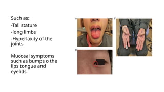 Hyperlaxator MEN SYNDROME.pptx detailed presentation. | PPTX