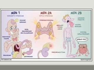 Comprehensive Overview of Multiple Endocrine Neoplasia (MEN) Syndromes ...