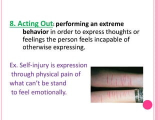 8. Acting Out: performing an extreme
behavior in order to express thoughts or
feelings the person feels incapable of
other...