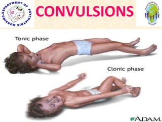 CONVULSIONS
 