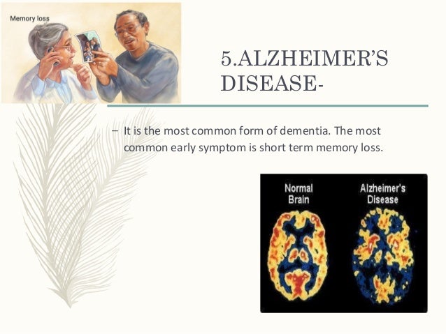 the prevalence and effects of the bipolar affective disorder on a population Seasonal depression, also known as seasonal affective disorder (sad) or the winter blues, is a subtype of depression or bipolar disorder that occurs and ends around. the prevalence and effects of the bipolar affective disorder on a population Seasonal depression, also known as seasonal affective disorder (sad) or the winter blues, is a subtype of depression or bipolar disorder that occurs and ends around.