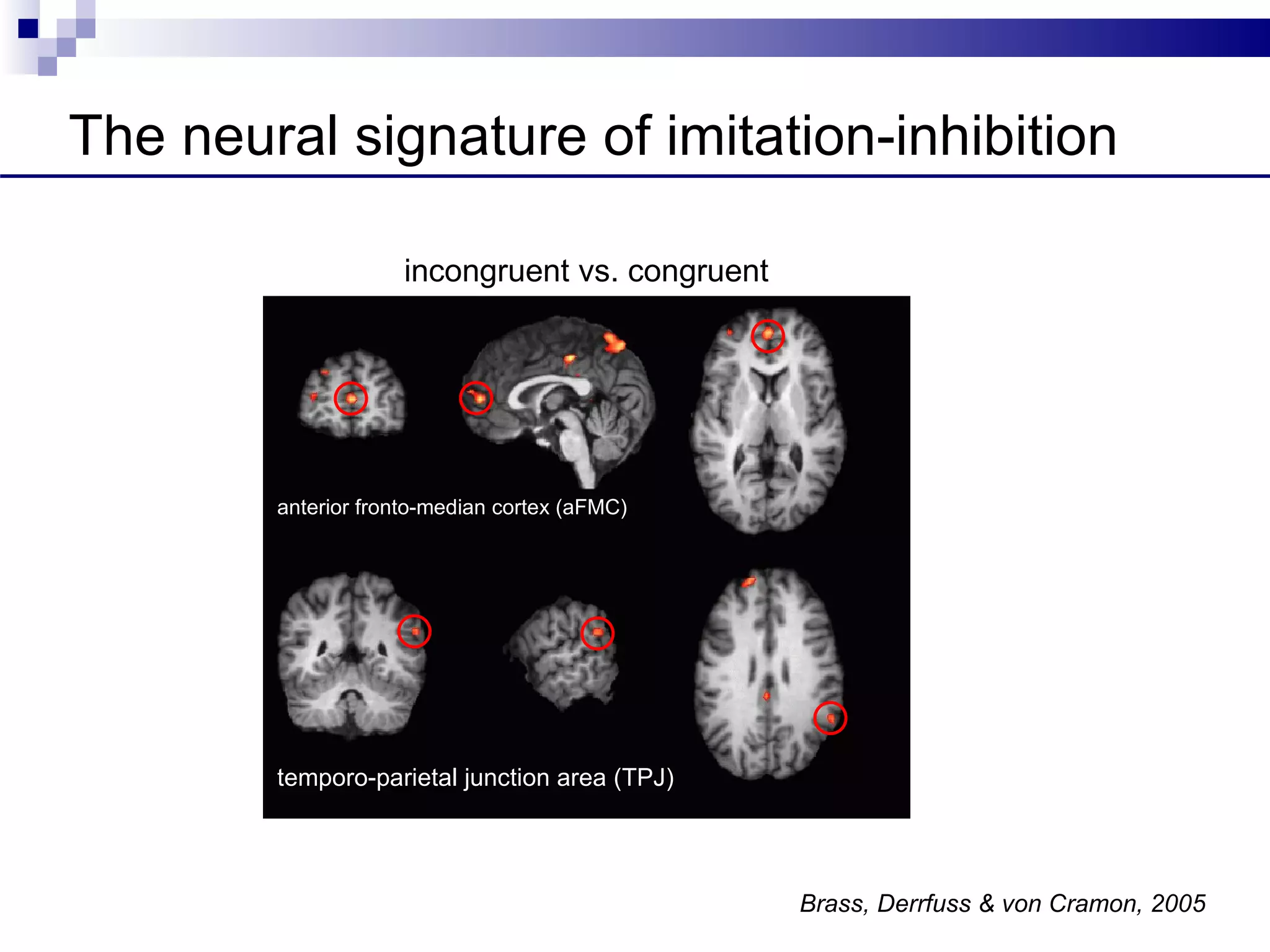 The neural signature of imitation-inhibition

                     incongruent vs. congruent




        anterior fronto-median cortex (aFMC)




        temporo-parietal junction area (TPJ)




                                                 Brass, Derrfuss & von Cramon, 2005
 