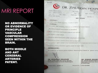 NO ABNORMALITY
OR EVIDENCE OF
PRINCIPLE
VASCULAR
COMPRESSION
SEEN WITHIN THE
BRAIN.
BOTH MIDDLE
AND ANT
CEREBRAL
ARTERIES
PATENT.
 