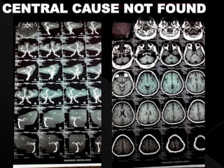 CENTRAL CAUSE NOT FOUND
 