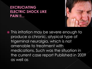  This irritation may be severe enough to
produce a chronic, atypical type of
trigeminal neuralgia, which is not
amenable to treatment with
medications. Such was the situation in
the current case report Published in 2009
as well as
EXCRUCIATING
ELECTRIC SHOCK LIKE
PAIN !!...
 