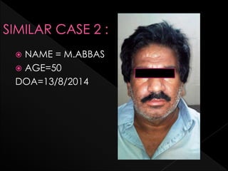  NAME = M.ABBAS
 AGE=50
DOA=13/8/2014
 