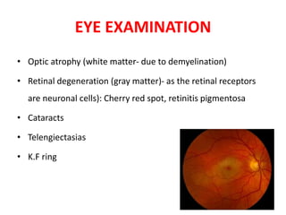 EYE EXAMINATION
• Optic atrophy (white matter- due to demyelination)
• Retinal degeneration (gray matter)- as the retinal receptors
are neuronal cells): Cherry red spot, retinitis pigmentosa
• Cataracts
• Telengiectasias
• K.F ring
 