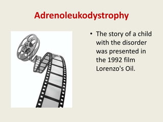 Adrenoleukodystrophy
           • The story of a child
             with the disorder
             was presented in
             the 1992 film
             Lorenzo's Oil.
 