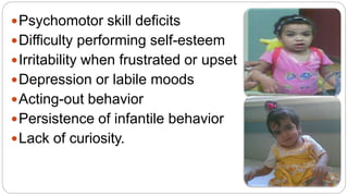 Psychomotor skill deficits
Difficulty performing self-esteem
Irritability when frustrated or upset
Depression or labile moods
Acting-out behavior
Persistence of infantile behavior
Lack of curiosity.
 