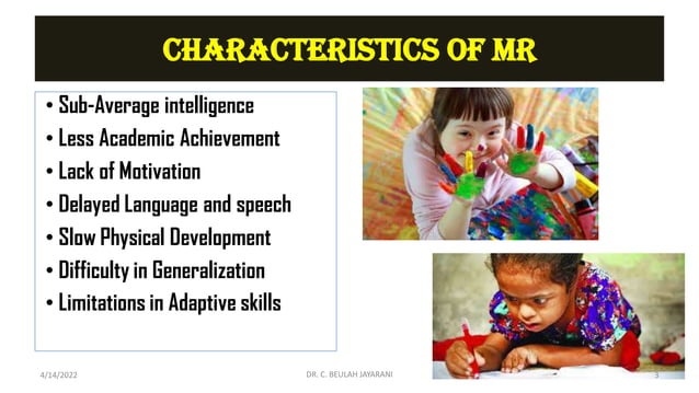 MENTAL RETARDATION pdf