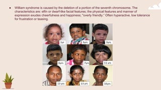 ● William syndrome is caused by the deletion of a portion of the seventh chromosome. The
characteristics are: elfin or dwarf-like facial features; the physical features and manner of
expression exudes cheerfulness and happiness; "overly friendly.“ Often hyperactive. low tolerance
for frustration or teasing.
 